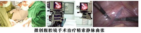 精索静脉曲张微创手术图片