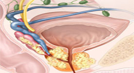 细菌性前列腺炎的症状