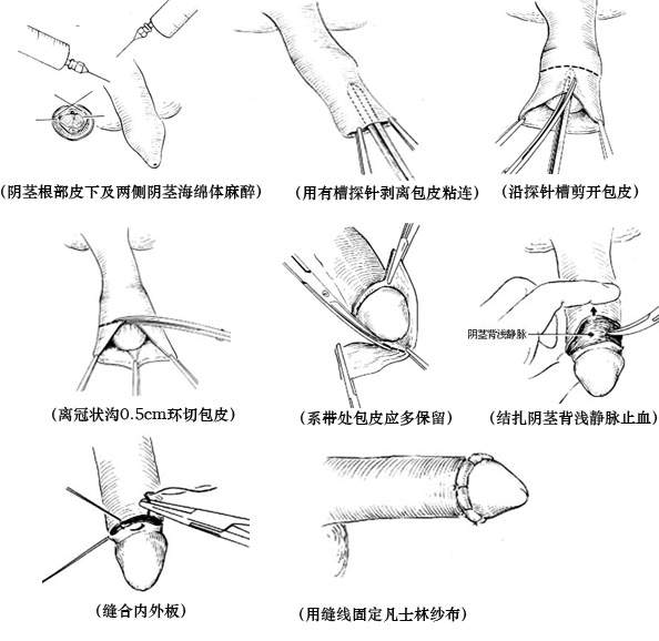 ��Ƥ����