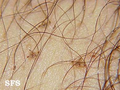 ͼ����ʭ����������ס�����ʭ